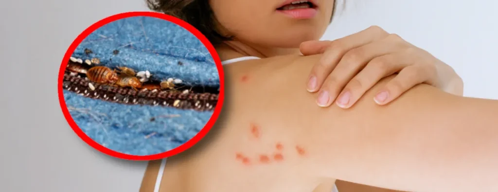 Bleiben morgens solche Spuren auf der Haut zurück? Werden Sie von diesen Insekten gebissen?